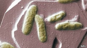 130326143418_bacterias__304x171_spl